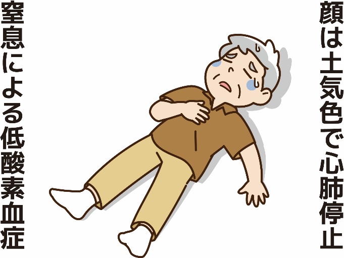 窒息による低酸素血症